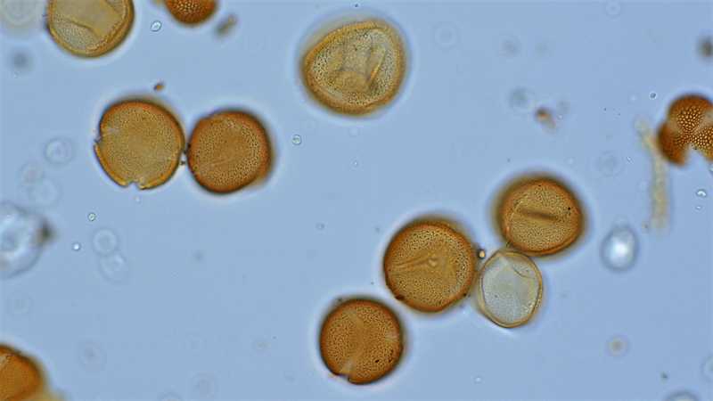Pylová zrna šťavelu kyselého (Oxalis acetosella L.) v trvalém preparátu naší Referenční pylové sbírky české květeny. Pylová zrna šťavelu kyselého (Oxalis acetosella L.) v trvalém preparátu naší Referenční pylové sbírky české květeny.